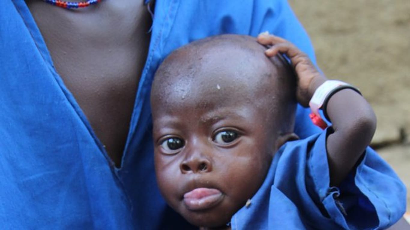 Hunger im Südsudan: Eine Mutter wartet mit ihrem unterernährten einjährigen Sohn vor einem Krankenhaus.
