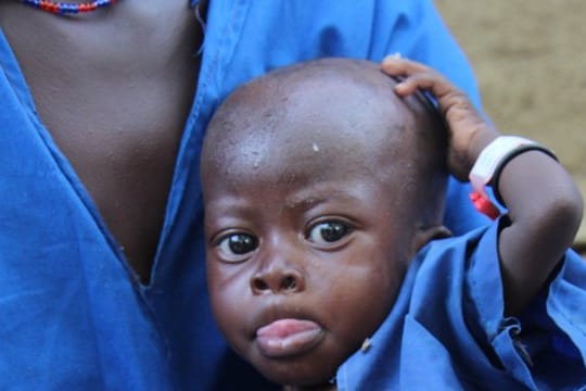 Hunger im Südsudan: Eine Mutter wartet mit ihrem unterernährten einjährigen Sohn vor einem Krankenhaus.
