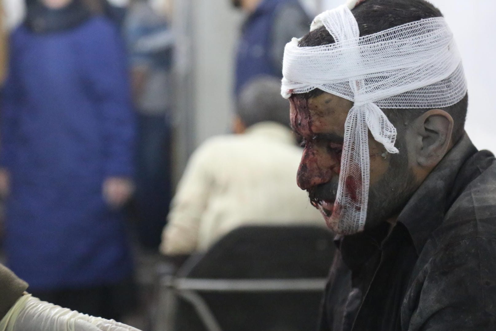 Kafr Batna in Ost-Ghuta: Ein Mann erhält Erste Hilfe, nachdem er während eines Luftangriffs durch die syrische Armee verwundet wurde.