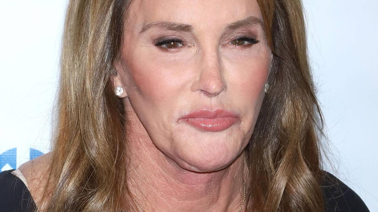 Caitlyn Jenner: Im Internet teilte sie ein Bild von einer Wunde.