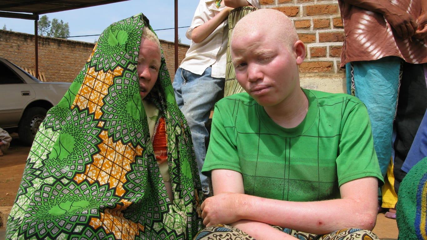Zwei Männer mit Albinismus in Afrika: In manchen afrikanischen Ländern herrscht der Aberglaube, Körperteile von Menschen mit Albinismus besäßen magische Kräfte.