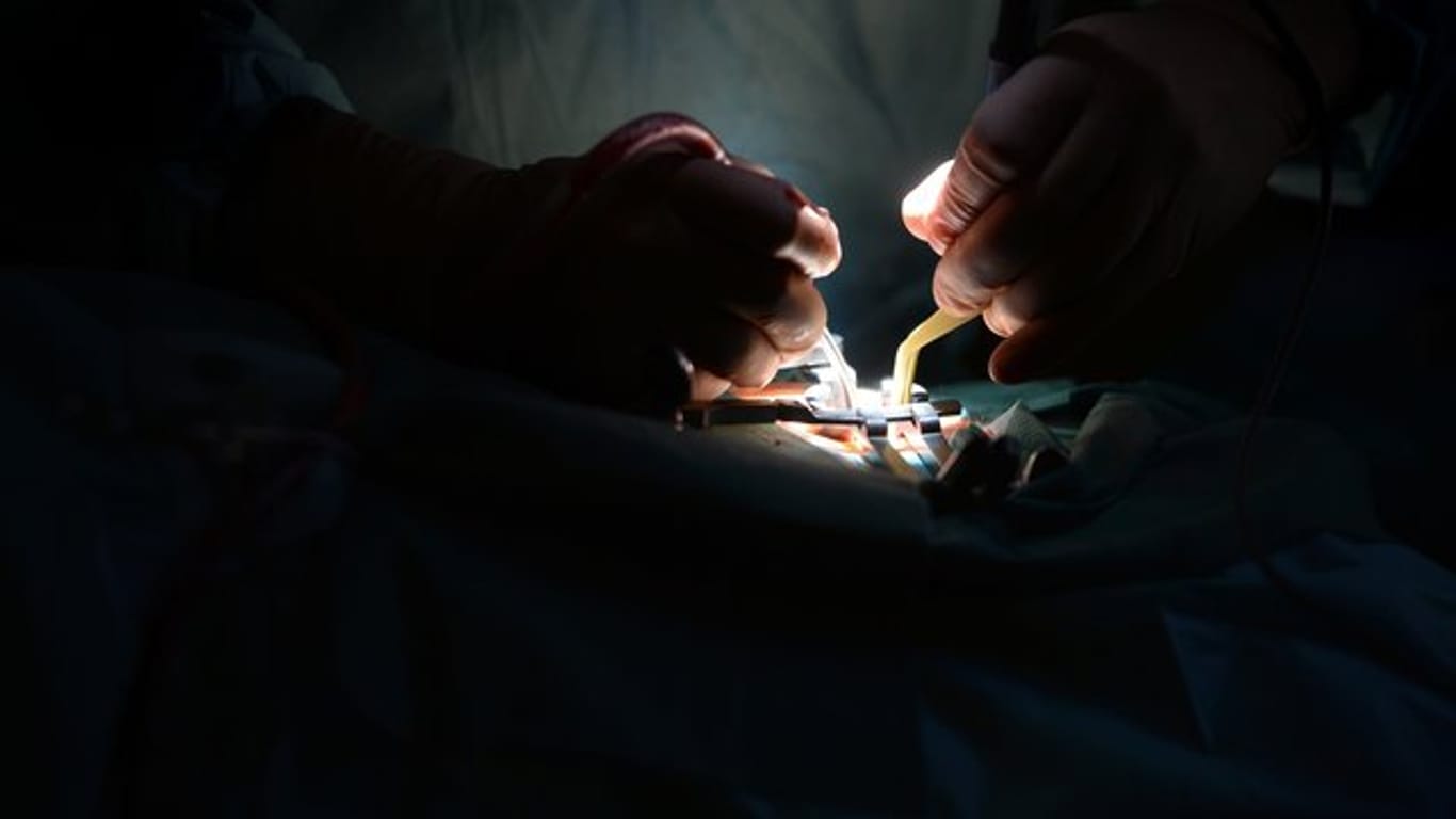 Mediziner während einer Bandscheibenoperation an der Lendenwirbelsäule.