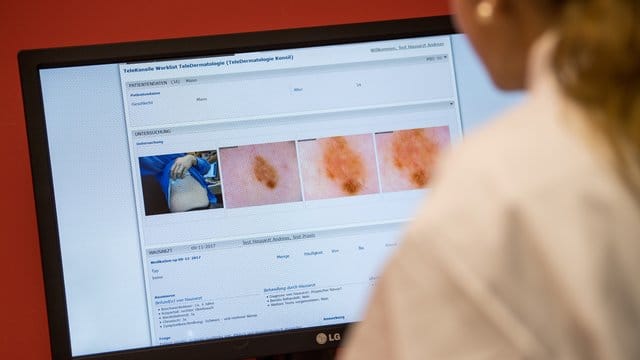 Telemedizin-Projektes für Hauterkrankungen: Eine Hautärztin präsentiert ein Programm, mit dem die Ärzte aus der Ferne Diagnosen feststellen. Telemedizin-Projektes für Hauterkrankungen: Eine Hautärztin präsentiert ein Programm, mit dem die Ärzte aus der Ferne Diagnosen feststellen.