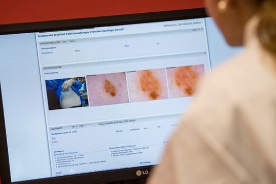 Telemedizin-Projektes für Hauterkrankungen: Eine Hautärztin präsentiert ein Programm, mit dem die Ärzte aus der Ferne Diagnosen feststellen.