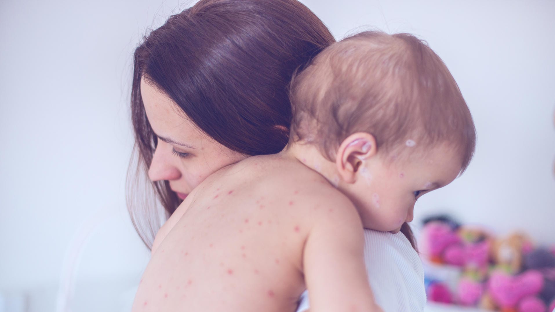 Mutter mit Baby mit Pusteln auf Arm