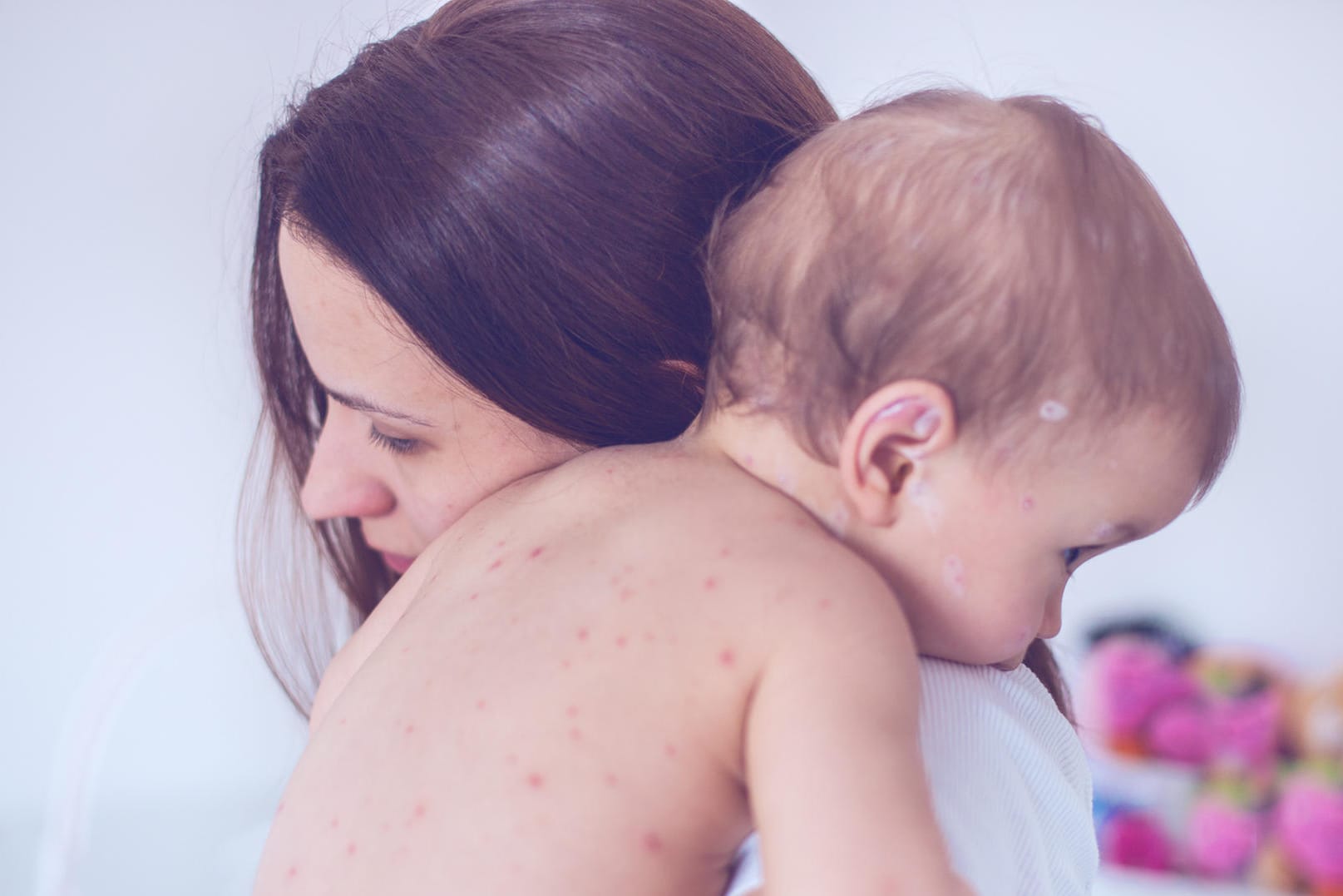 Mutter mit Baby mit Pusteln auf Arm