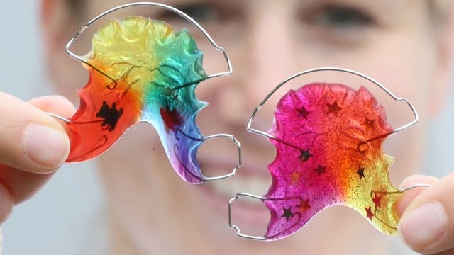 Zahnspangen in Regenbogenfarben.