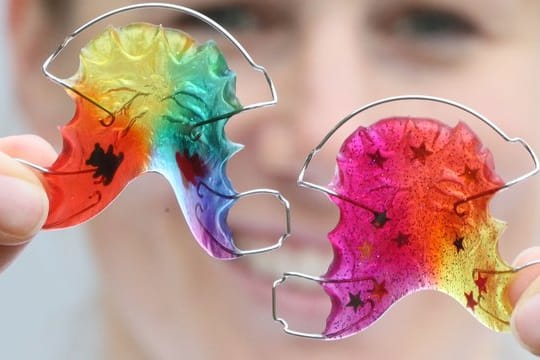 Zahnspangen in Regenbogenfarben.