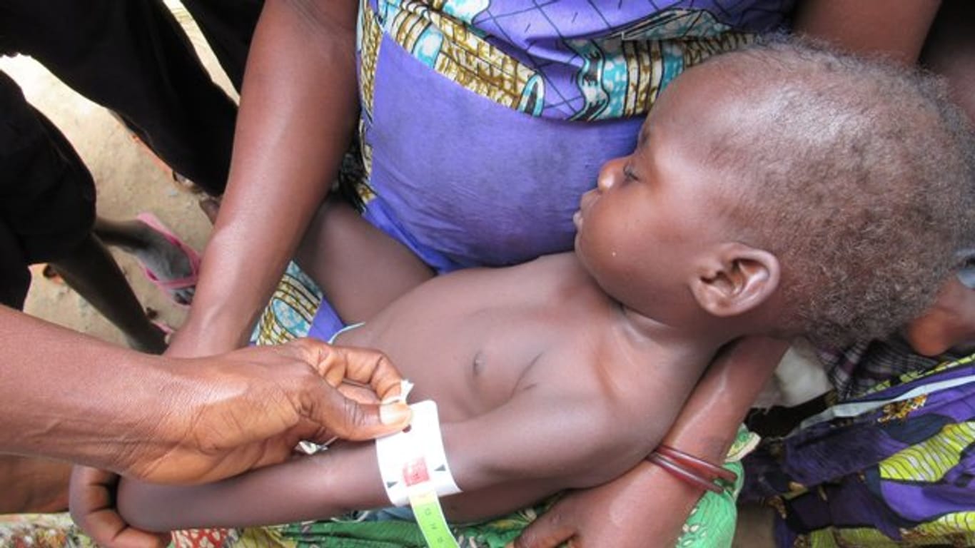 Ein Baby wird gewogen und vermessen, um den Grad seiner Unterernährung zu ermitteln.