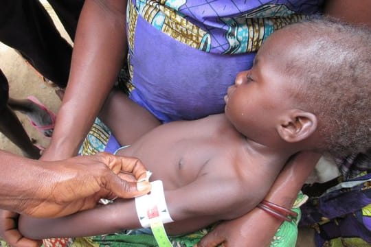 Ein Baby wird gewogen und vermessen, um den Grad seiner Unterernährung zu ermitteln.