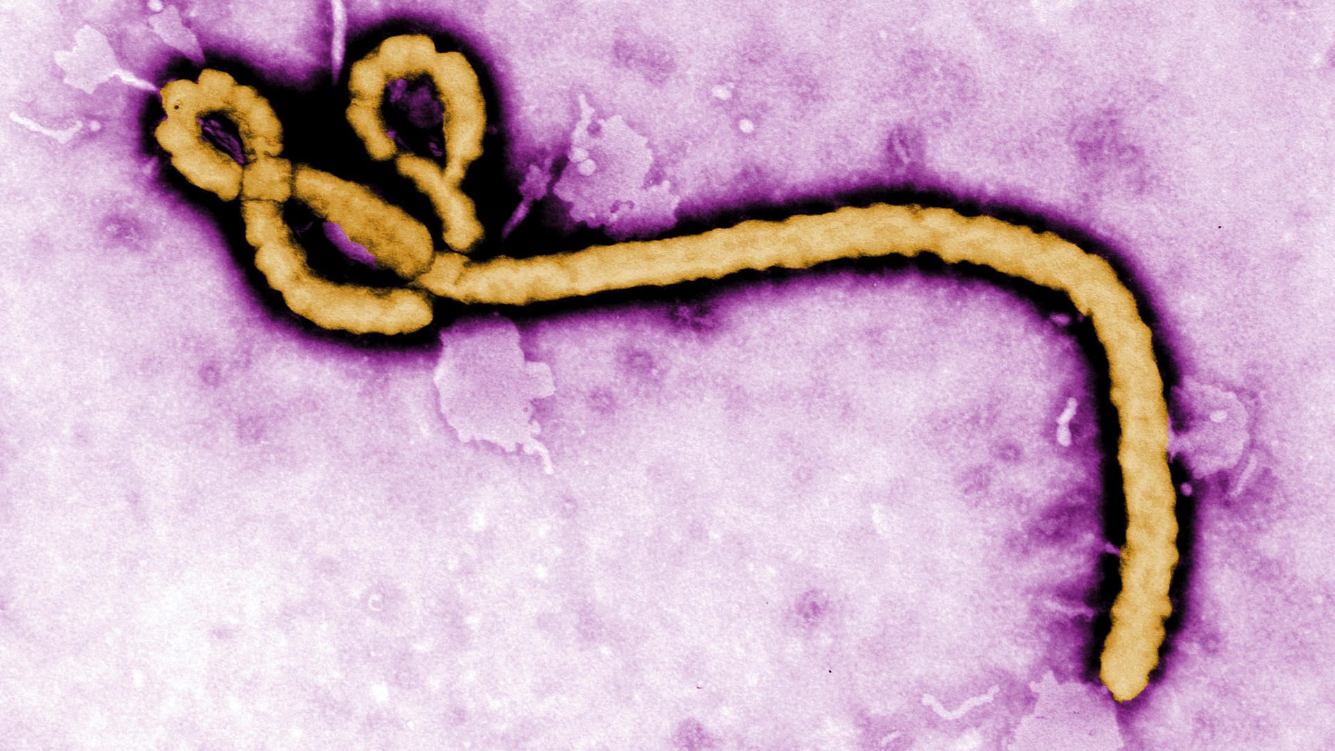 Ein einzelnes Viruspartikel des Ebola-Virus unter dem Elektronenmikroskop: Die Weltgesundheitsorganisation schlägt wegen des neuen Ausbruchs im Kongo Alarm. Ein einzelnes Viruspartikel des Ebola-Virus unter dem Elektronenmikroskop: Die Weltgesundheitsorganisation schlägt wegen des neuen Ausbruchs im Kongo Alarm.