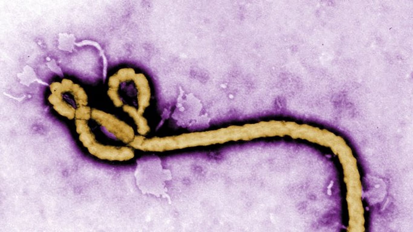 Die Aufnahme eines Elektronenmikroskops zeigt ein Partikel des Ebola-Virus.
