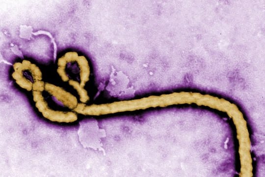 Die Aufnahme eines Elektronenmikroskops zeigt ein Partikel des Ebola-Virus.
