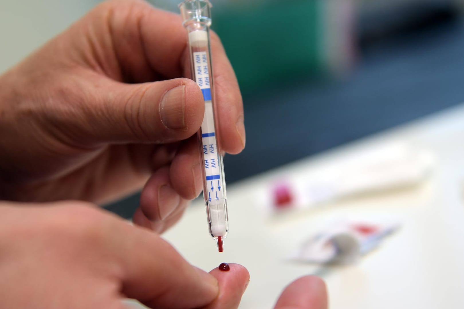 HIV-Test: Ein Mann verklagte seine Ärzte erfolgreich nachdem sie versäumten ihn auf das Virus zu testen.