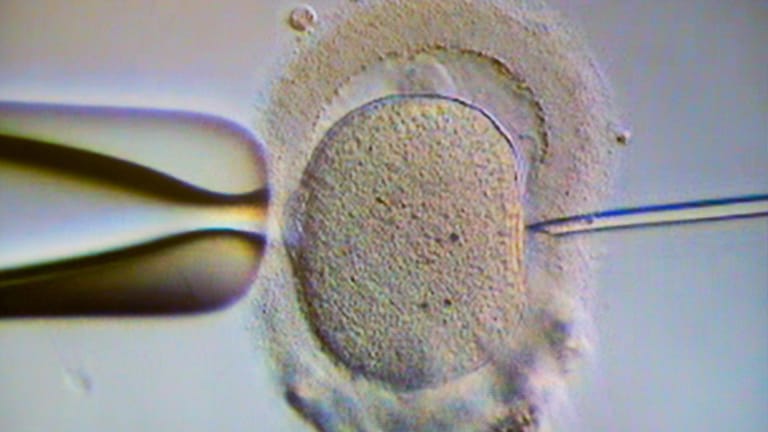 Künstliche Befruchtung: Ein Monitor zeigt im Kinderwunschzentrum Magdeburg eine Intrazytoplasmatische Spermieninjektion (Icsi).