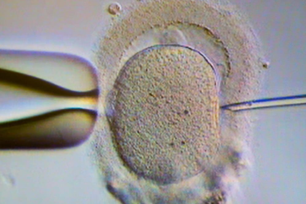 Künstliche Befruchtung: Ein Monitor zeigt im Kinderwunschzentrum Magdeburg eine Intrazytoplasmatische Spermieninjektion (Icsi).