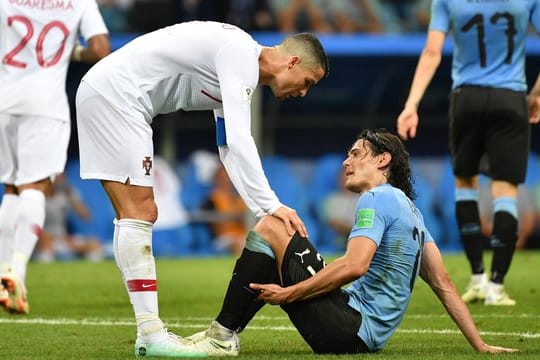 Nach seiner Wadenverletzung ist der Einsatz von Edinson Cavani fraglich.