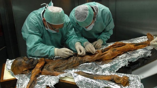 Forscher sind bei der Probenahme des Mageninhaltes der Mumie Ötzi. Forscher sind bei der Probenahme des Mageninhaltes der Mumie Ötzi.