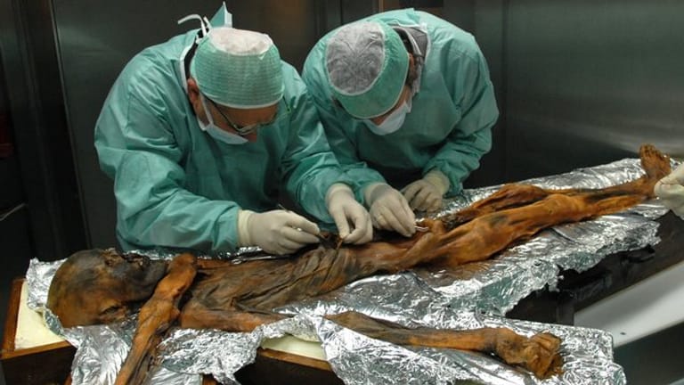 Forscher sind bei der Probenahme des Mageninhaltes der Mumie Ötzi.