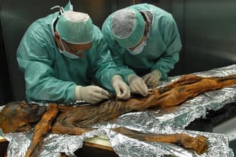 Forscher sind bei der Probenahme des Mageninhaltes der Mumie Ötzi.