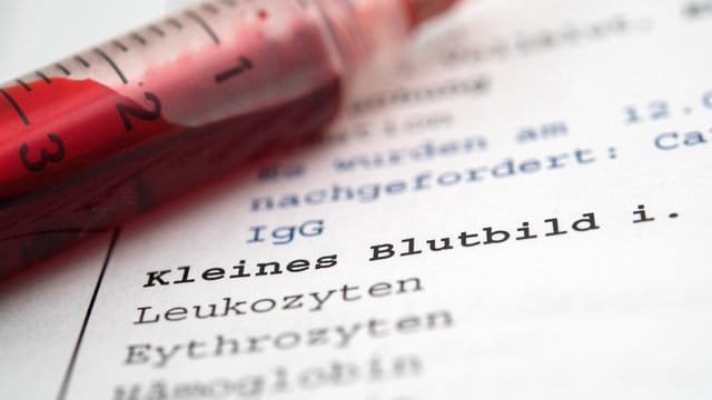 Laborbericht mit Blutwerten: Ein Blutbild sieht für viele Patienten kryptisch und verwirrend aus. Am besten besprechen Sie mit ihrem Arzt, was die Ergebnisse genau bedeuten.