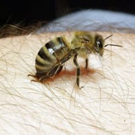 Eine Biene setzt zum Stich an: Gehen Schwellungen nach einem Bienenstich nach drei bis vier Tagen nicht zurück, sollten Sie einen Arzt aufsuchen.