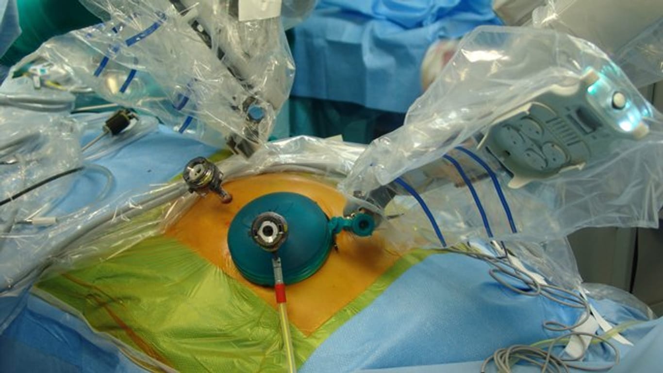 Transplantation einer Bauchspeicheldrüse durch einen Roboter.
