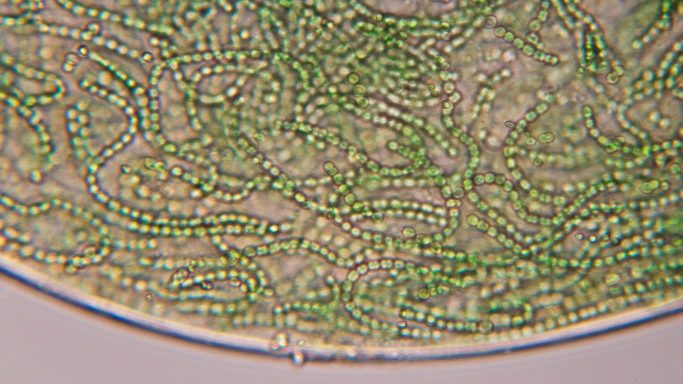 Cyanobakterien unter einem Mikroskop: Die Gifte der Blaualge können Hautreizungen auslösen.