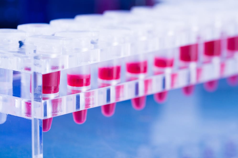 Reagenzgläser für Krebs-Bluttest: Für Blutkrebs-Patienten in der EU wurde eine Gentherapie zugelassen (Symbolbild).