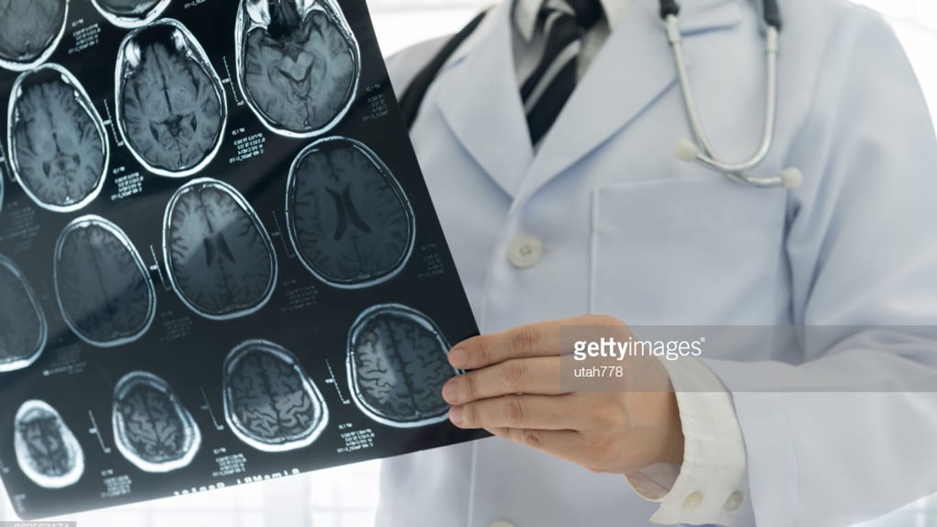 Mithilfe einer MRT lässt sich feststellen, welche Bereiche des Gehirns vom Schlaganfall betroffen sind.