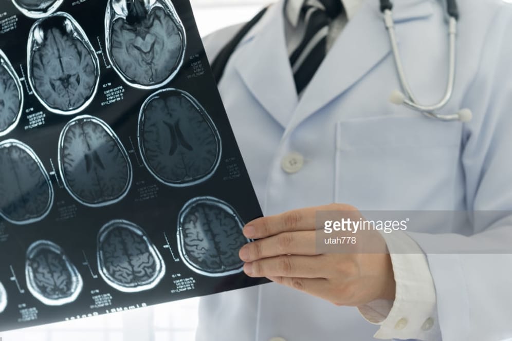 Mithilfe einer MRT lässt sich feststellen, welche Bereiche des Gehirns vom Schlaganfall betroffen sind.