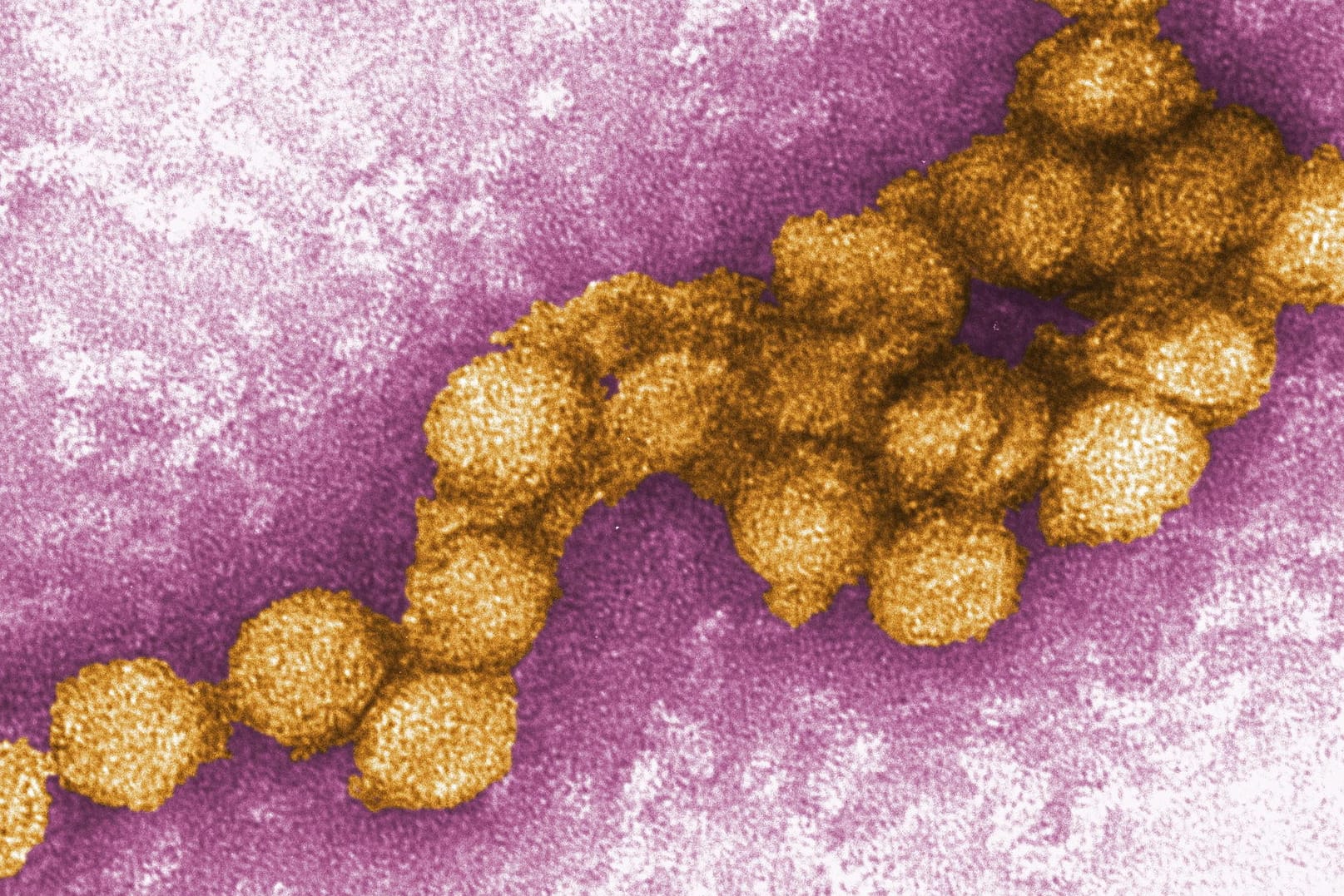 Der West-Nil-Virus unter dem Elektronenmikroskop: Südeuropäische Länder melden derzeit verstärkt tödliche Fälle von West-Nil-Fieber.