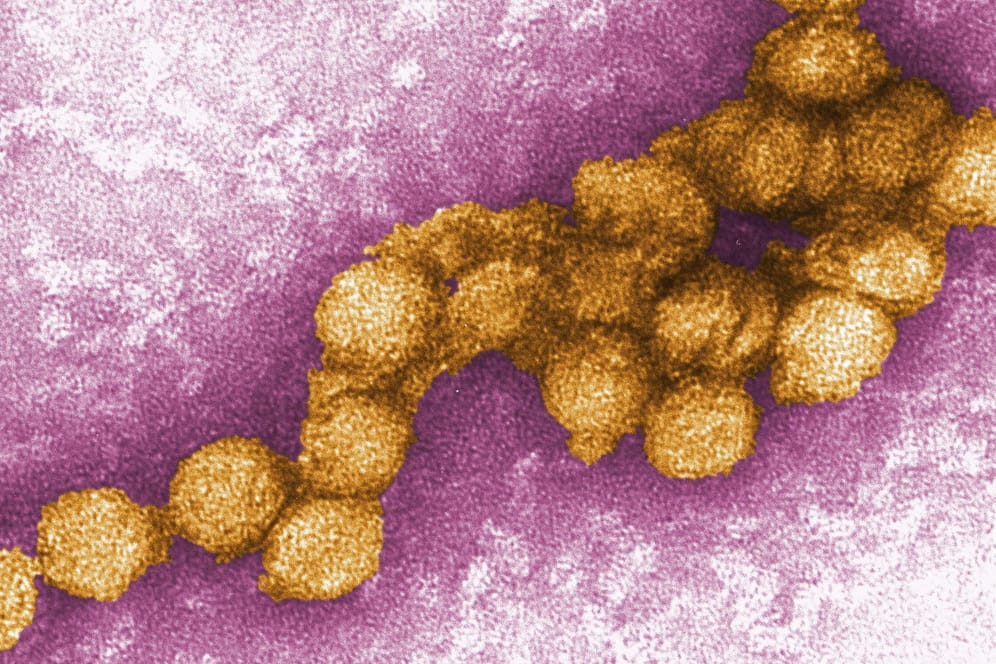 Der West-Nil-Virus unter dem Elektronenmikroskop: Südeuropäische Länder melden derzeit verstärkt tödliche Fälle von West-Nil-Fieber.