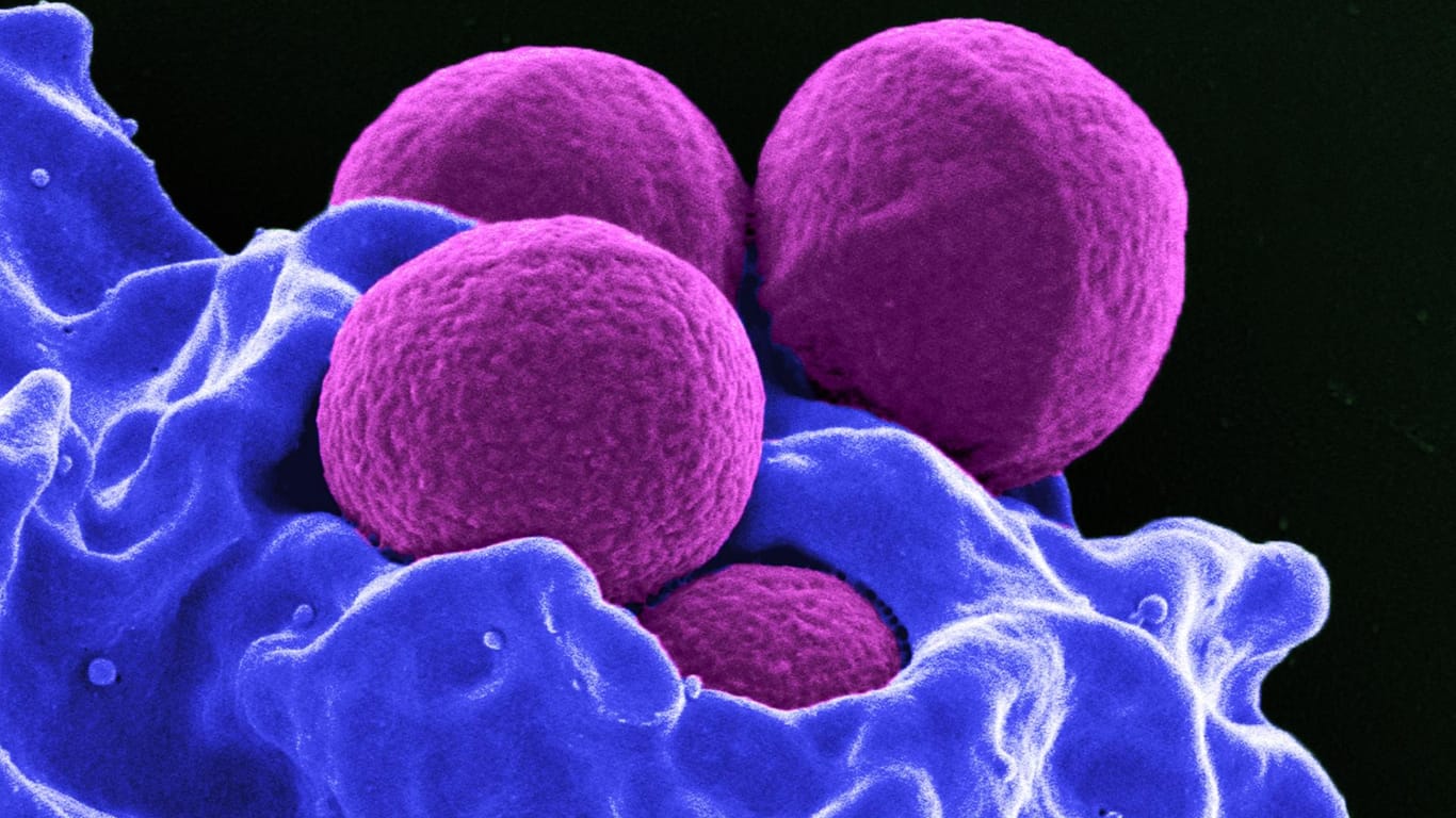 Produziert vom National Institute of Allergy and Infectious Diseases (NIAID), zeigt diese digital gefärbte Rasterelektronenmikroskopie (REM) vier magentafarbene, kugelförmige Methicillin-resistente Staphylococcus aureus (MRSA) Bakterien, die von blau gefärbten weißen Blutkörperchen (WBCs) phagozysiert werden.