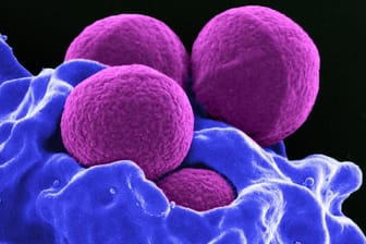Produziert vom National Institute of Allergy and Infectious Diseases (NIAID), zeigt diese digital gefärbte Rasterelektronenmikroskopie (REM) vier magentafarbene, kugelförmige Methicillin-resistente Staphylococcus aureus (MRSA) Bakterien, die von blau gefärbten weißen Blutkörperchen (WBCs) phagozysiert werden.