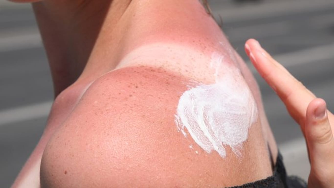Sonnencreme beugt Hautkrebs vor.