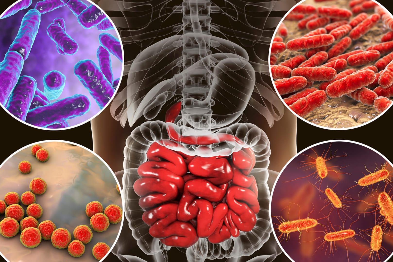 Darmflora des Dünndarms: Hier tummeln sich verschiedene Mikroben wie Bifidobakterien, Laktobazillen, Enterococcus and Escherichia coli.