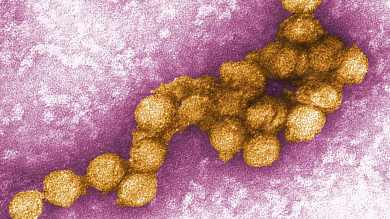 Foto zeigt eine elektronenmikroskopische Aufnahme des West-Nil-Virus