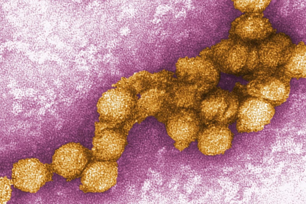 Foto zeigt eine elektronenmikroskopische Aufnahme des West-Nil-Virus