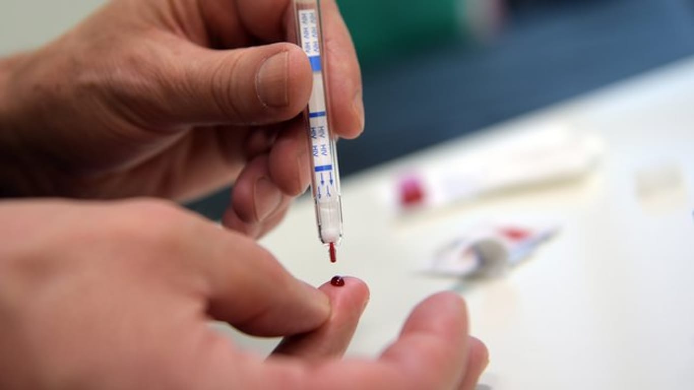 Künftig sollen HIV-Selbsttests für alle in Apotheken oder Drogeriemärkten erhältlich sein.