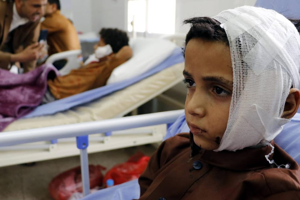 Verletzte Kinder: Im Bürgerkriegsland Jemen will die von Saudi-Arabien geführte Militärkoalition nun Hilfskorridore öffnen.