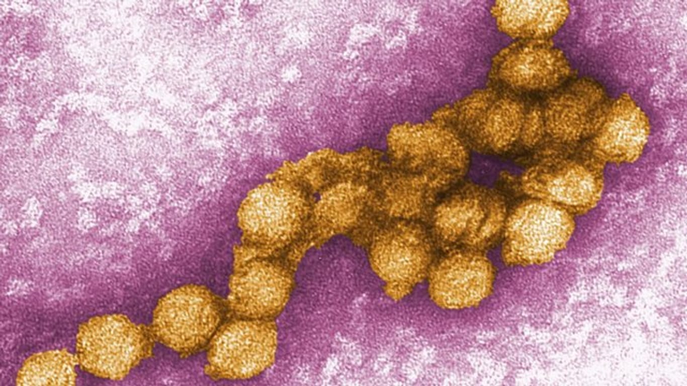 Das West-Nil-Virus breitet sich auch in Deutschland aus.