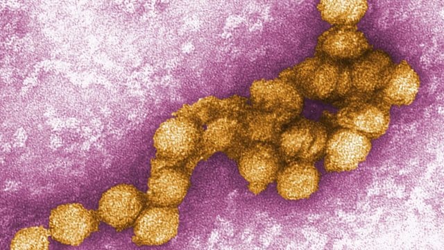 Das West-Nil-Virus breitet sich auch in Deutschland aus. Das West-Nil-Virus breitet sich auch in Deutschland aus.