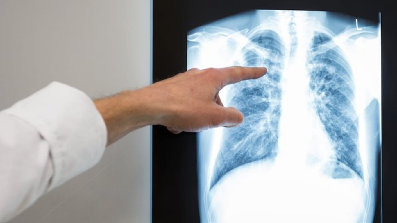 Lungenärzte weisen auf Gesundheitsrisiken durch verschmutzte Luft hin.