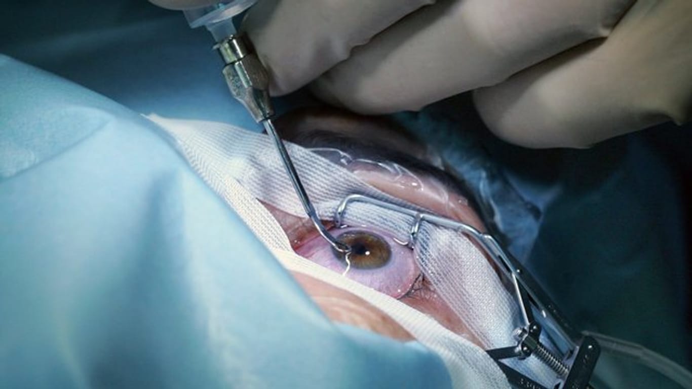 Ein Patient beim Augenlasern in der EuroEyes-Klinik im Sony-Center.