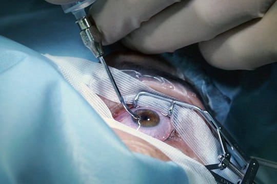 Ein Patient beim Augenlasern in der EuroEyes-Klinik im Sony-Center.