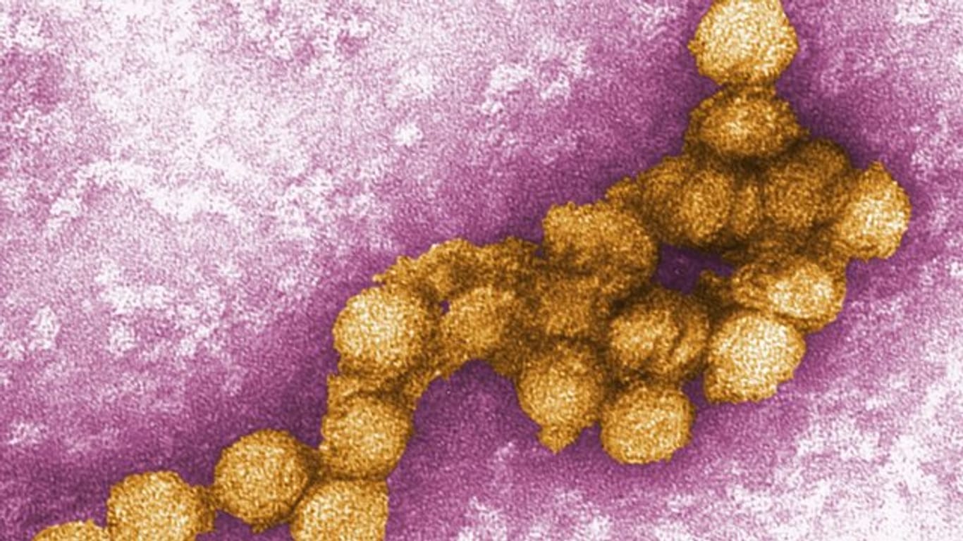 Das West-Nil-Virus in der Aufnahme eines Elektronenmikroskops.