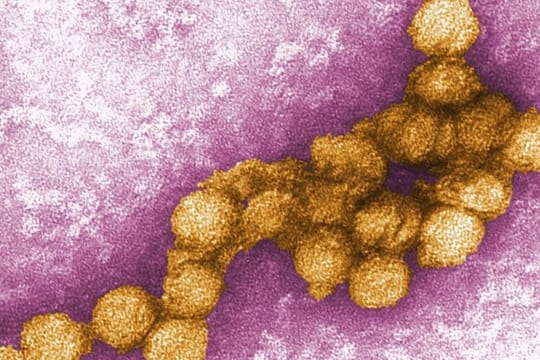 Das West-Nil-Virus in der Aufnahme eines Elektronenmikroskops.