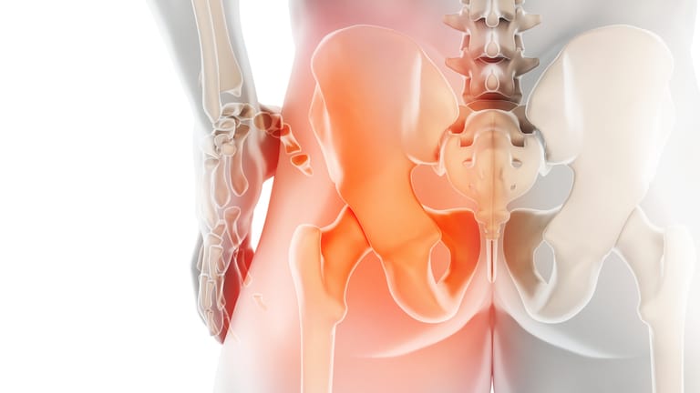 Knochenschwund: Osteoporose ist ein schleichender Prozess. Viele bemerken die Krankheit erst, wenn es zum Knochenbruch kommt.