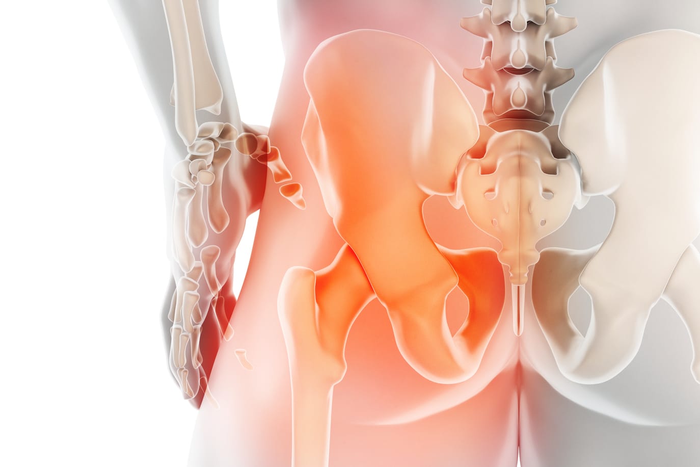 Knochenschwund: Osteoporose ist ein schleichender Prozess. Viele bemerken die Krankheit erst, wenn es zum Knochenbruch kommt.